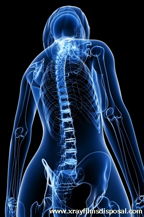 Fort Worth X-ray film disposal