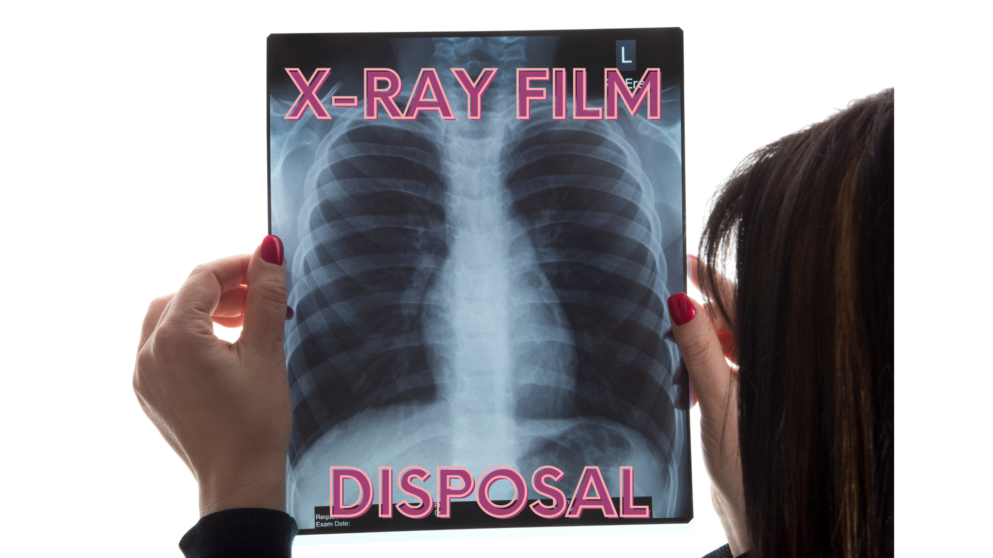 X-ray film recycling services